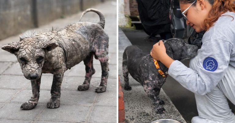 Abandoned With Skin Like Cement, He Found Love Where No One Expected